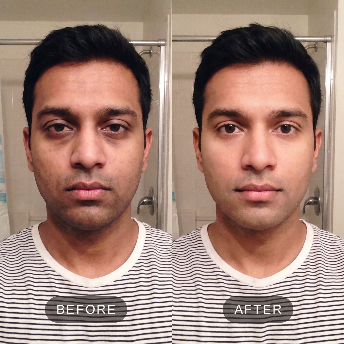 VITA Serum Shot