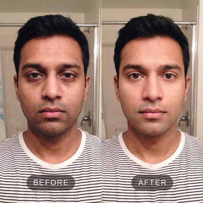 VITA Serum Shot