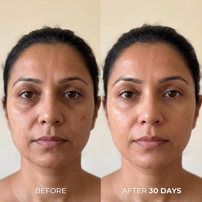 VITA Serum Shot